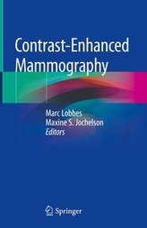 Contrast-Enhanced Mammography