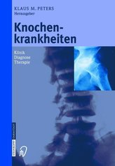 Knochenkrankheiten