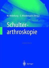Schulterarthroskopie