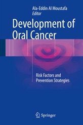 Development of Oral Cancer