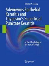 Adenovirus Epithelial Keratitis and Thygeson\'s Superficial Punctate Keratitis