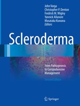 Scleroderma
