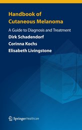 Handbook of Cutaneous Melanoma