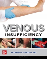 Venous Insufficiency