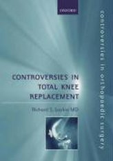 Controversies in Total Knee Replacement