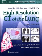 Webb, Muller and Naidich's High-Resolution CT of the Lung