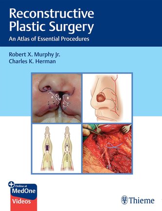 Reconstructive Plastic Surgery