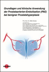 Grundlagen und klinische Anwendung der Prostataarterien-Embolisation (PAE) bei benigner Prostatahyperplasie