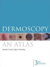 Dermoscopy: An Atlas