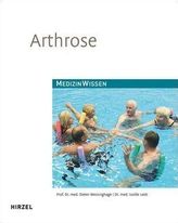 Arthrose