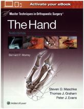 Master Techniques in Orthopaedic Surgery: The Hand