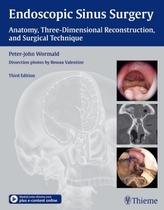 Endoscopic Sinus Surgery