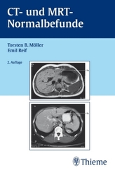 Atlas der menschlichen Anatomie und der Chirurgie / The Complete Atlas of Human Anatomy and Surgery. Atlas d' anatomie humaine e
