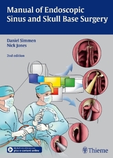 Manual of Endoscopic Sinus Surgery