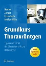 Grundkurs Thoraxröntgen, m. CD-ROM