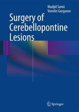 Surgery of Cerebellopontine Lesions