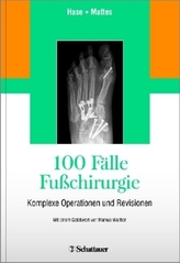 100 Fälle Fußchirurgie