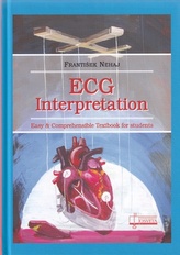 ECG  - Interpretation