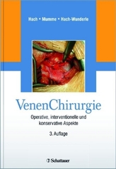 VenenChirurgie