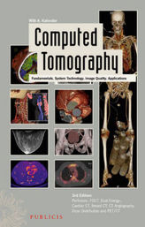 Computed Tomography, w. CD-ROM