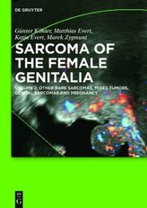 Sarcoma of the female genitalia. Vol.2