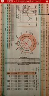 EKG-Lineal pocketcard