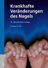 Krankhafte Veränderungen des Nagels