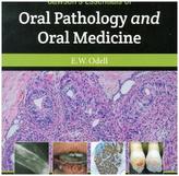 Cawson's Essentials of Oral Pathology and Oral Medicine