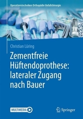 Zementfreie Hüftendoprothese: lateraler Zugang nach Bauer