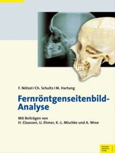 Fernröntgenseitenbild-Analyse