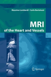  MRI of the Heart and Vessels