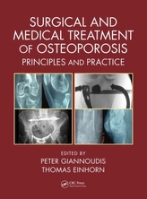  Surgical and Medical Treatment of Osteoporosis