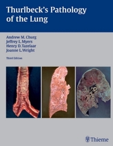 Thurlbeck's Pathology of the Lung