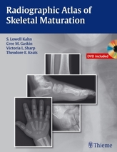 Radiographic Atlas of Skeletal Maturation, m. DVD-ROM