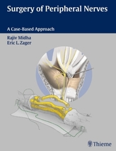 Surgery of Peripheral Nerves