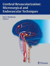 Cerebral Revascularization
