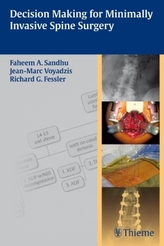 Decision Making for Minimally Invasive Spine Surgery