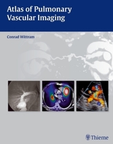 Atlas of Pulmonary Vascular Imaging