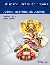 Sellar and Parasellar Tumors