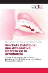 Brackets Estéticos: Una Alternativa discreta en la Ortodoncia