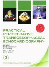 Practical Perioperative Transoesophageal Echocardiography