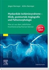 Myokardiale Ischämiesyndrome - Klinik, postmortale Angiografie und Pathomorphologie