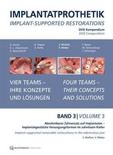 DVD-Kompendium Implantatprothetik 3