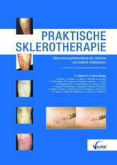 Praktische Sklerotherapie