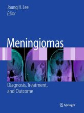 Meningiomas