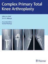 Complex Primary Total Knee Arthroplasty