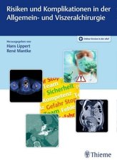 Risiken und Komplikationen in der Allgemein- und Viszeralchirurgie, m. 1 Buch, m. 1 E-Book