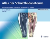 Atlas der Schnittbildanatomie. Bd.3