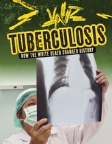  Tuberculosis