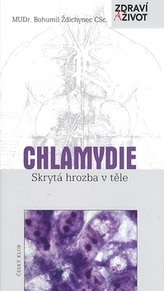 Chlamydie Skrytá hrozba v těle